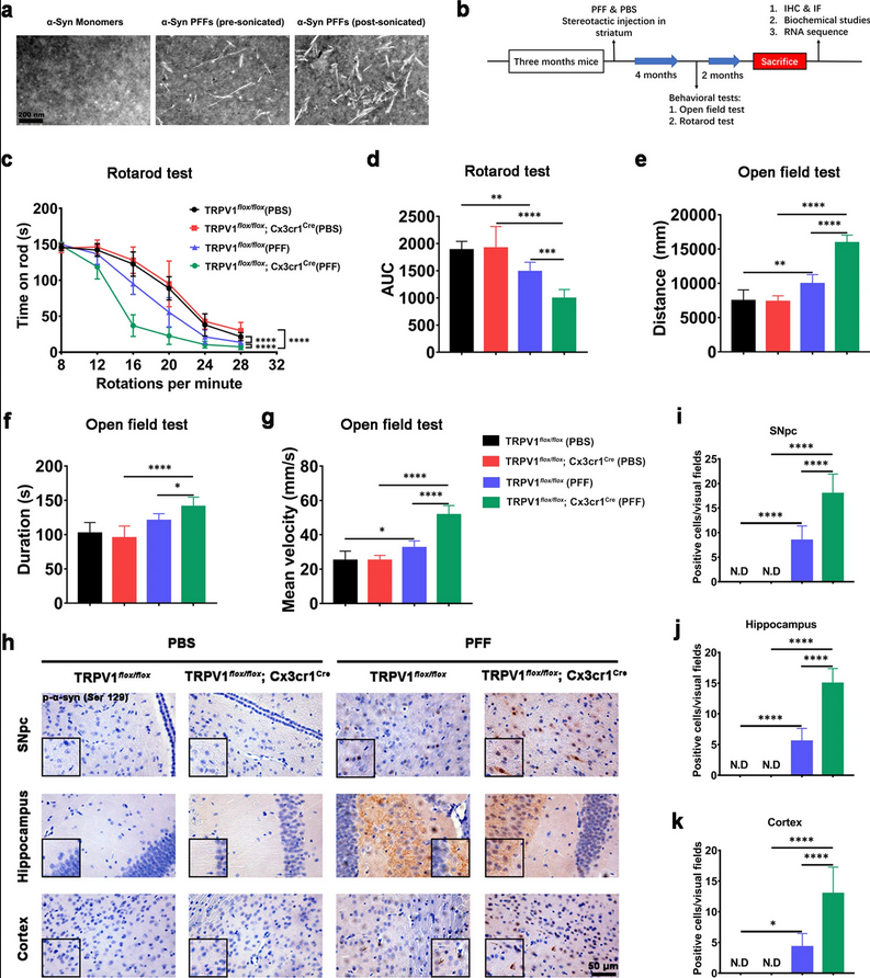 ScienceofPD's tweet photo. TRPV1 agonist capsaicin reduces phosphorylation of #Parkinsons-associated α-synuclein in primary neurons by boosting phagocytosis in PFF-tolerant microglia in vitro; "Modulating microglial metabolism might be a new therapeutic strategy for PD"
https://t.co/SdwJyxnSZD https://t.co/zFNVjKQZWX