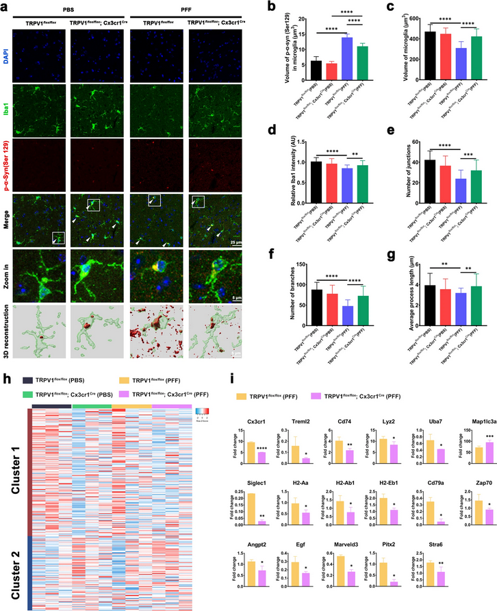 ScienceofPD's tweet photo. TRPV1 agonist capsaicin reduces phosphorylation of #Parkinsons-associated α-synuclein in primary neurons by boosting phagocytosis in PFF-tolerant microglia in vitro; "Modulating microglial metabolism might be a new therapeutic strategy for PD"
https://t.co/SdwJyxnSZD https://t.co/zFNVjKQZWX