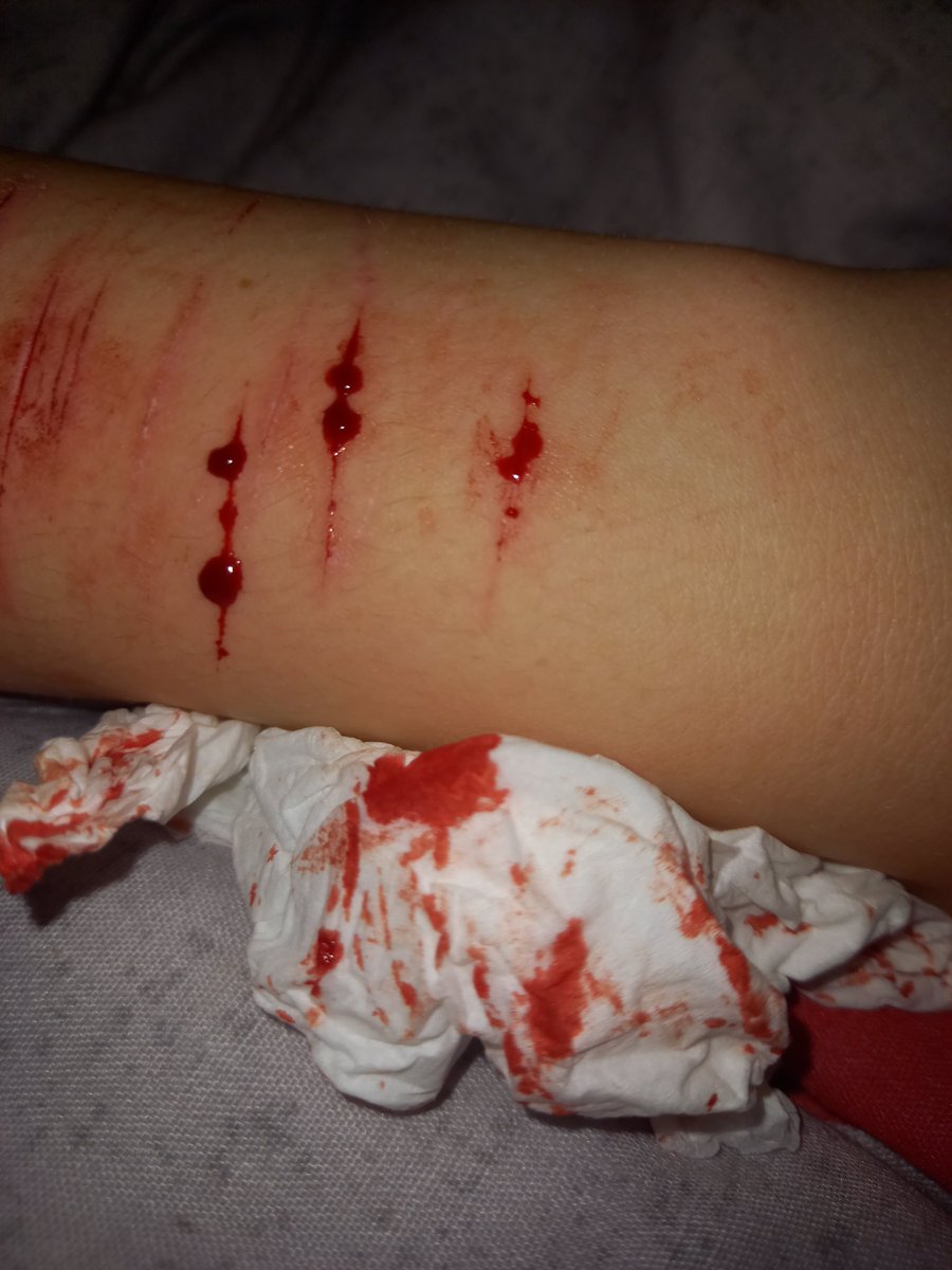 oingoboingfan86's tweet photo. My favs from my old account, im hoping to break open my sharpener so i can start again
#shtwt | #ouchietwt | #catscratchtwt | #strawberryfilling https://t.co/CKikcQVAle