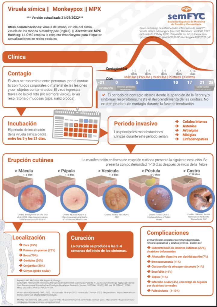 FernandoFabiani's tweet photo. Infografía sobre manejo de la Viruela del mono en Atención Primaria #monkeypox En PDF: https://t.co/xc7gHLcpDi vía @semfyc https://t.co/xfcDatixIQ