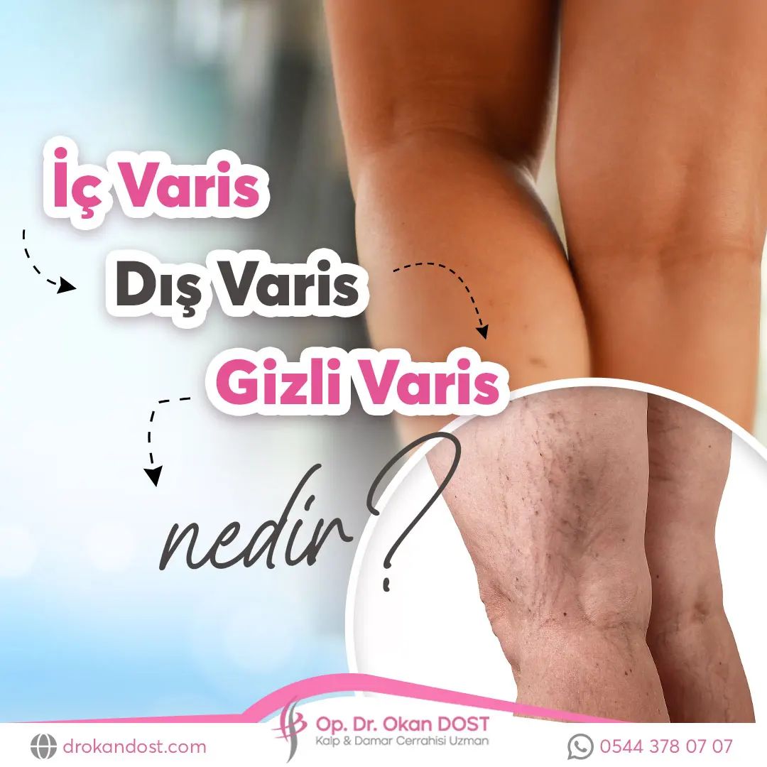 hdbilisim's tweet image. drokandost.com Op. Dr. Okan DOST, web tasarım ve SEO çalışması konusunda referanslarımıza eklenmiştir.
Op. Dr. Okan DOST Adana ve İstanbul kliniğinde varis tedavisi yapan doktorlar arasındır. 
#webtasarım #seo #adanawebtasarım #istanbulwebtasarım #varis #varistedavisi