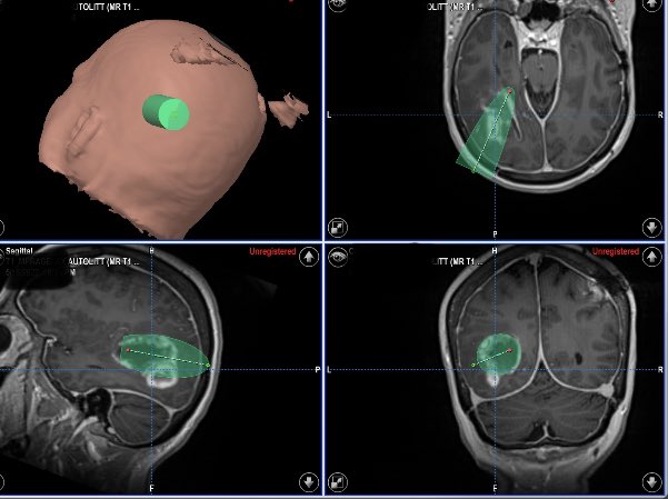 Hamid Borghei-Razavi, MD, FACS tweet media