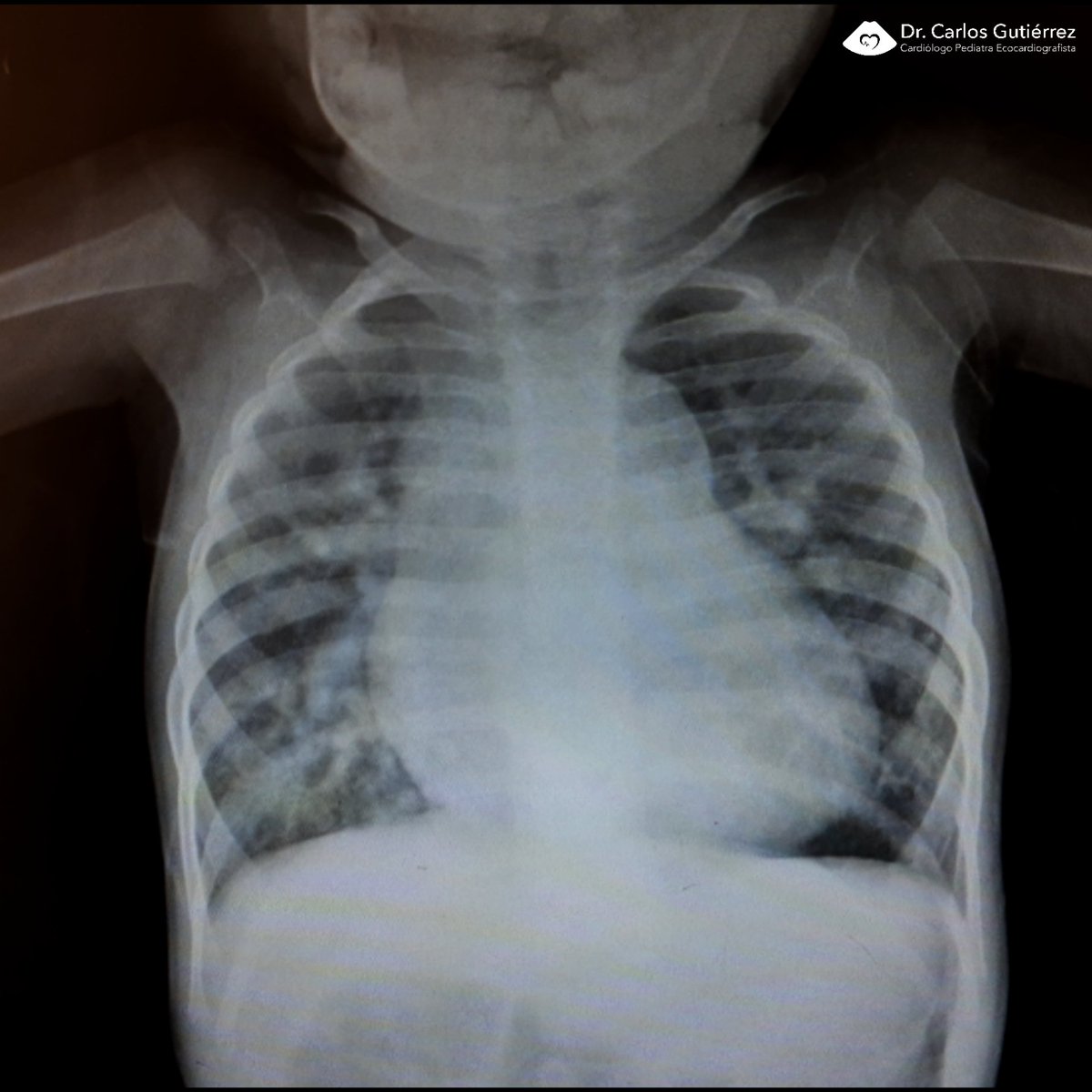 Dr Carlos Gutiérrez Torpey tweet media