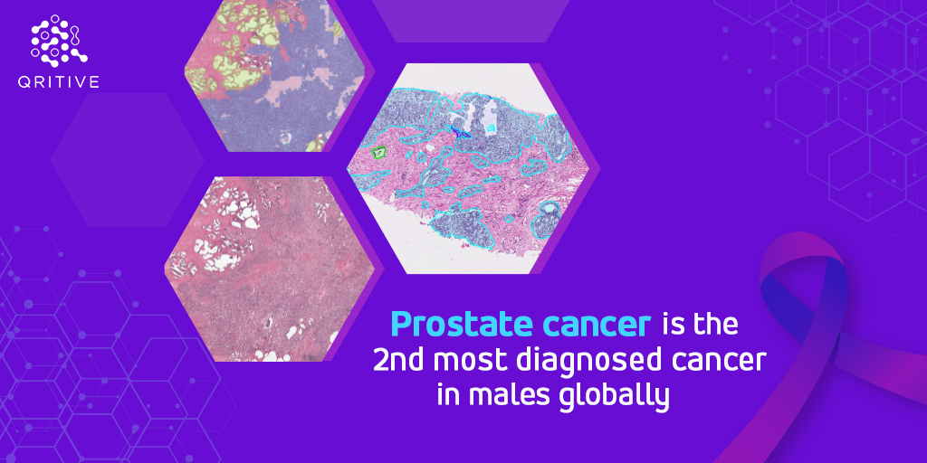 70% of clinical decisions involve #pathology. This suggests the central role it plays in our healthcare systems. As the world continues to battle the rise in #chronic diseases, pathology will play an increasingly pivotal role in #disease diagnosis and management.