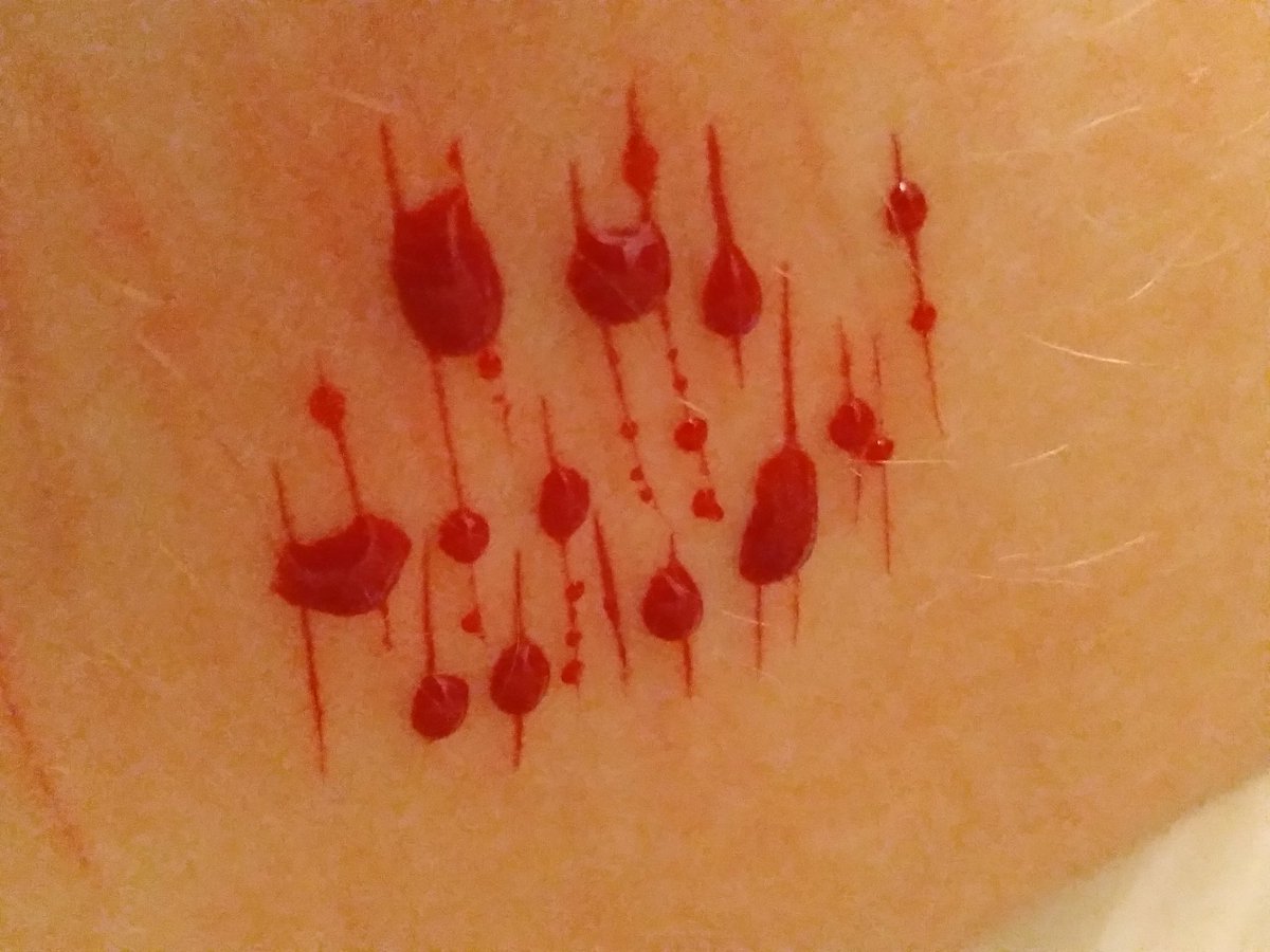toxicblazers's tweet photo. theze wouldnt stop ble3ding, some good lil styrozzz :)

shtwt bloodtwt styrotwt ouchietwt barcodetwt 198twt raspberryfillingtwt catscratchtwt sliceytwt yeettwt https://t.co/LIIQjF68Ex