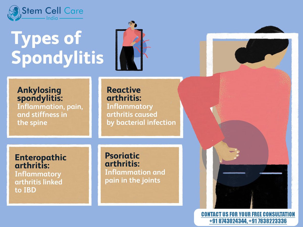 Type of Spondylitis

To know more about stem cells and the treatment for #Spondylitis Kindly visit the Website- stemcellcareindia.com
Email id- info@stemcellcareindia.com
Ph no- +918743024344
#AnkylosingSpondylitis #spondylitistreatment #stemcellforSpondylitis #stemcelltherapy