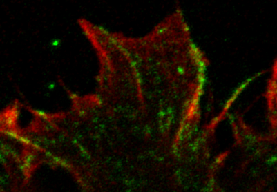 EricTheveneau's tweet photo. Zoom on a protrusion in Xenopus neural crest cell.
Actin in red, immunostaining in green. 
Can anyone guess what is the protein shown in green?
I bet you can't!!!
#Xenopus #neuralcrest #cellmigration #actin #focaladhesion https://t.co/fSS7A7ccRu