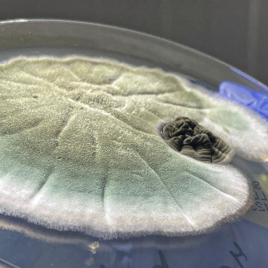 Aspergillus Fumigatus 💚💚💚 And Cladosporium So.