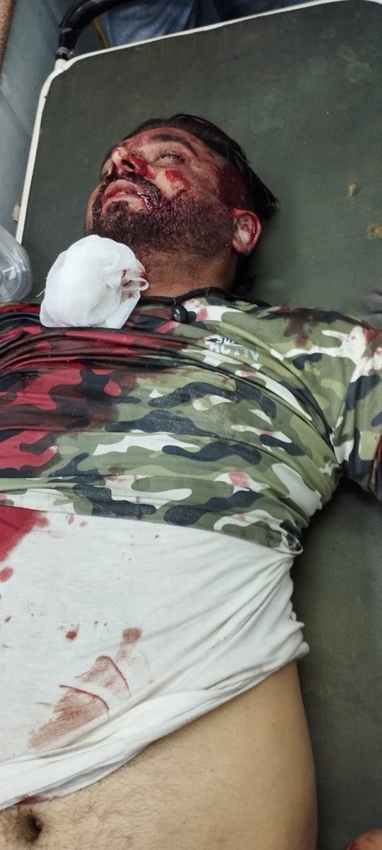 News18Jammu's tweet photo. Terrorist fired upon one policeman Saifullah Qadri S/o Mohd Syed Qadri, R/o Malik Saab, in Soura (Anchar) area. He is critically injured. His daughter also got injured. https://t.co/H9A0oYDptc