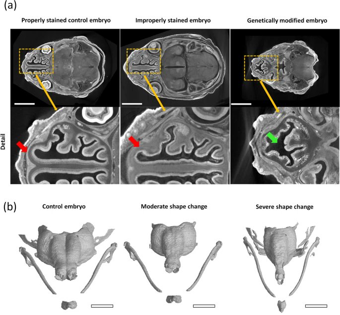 Innov_Inf's tweet photo. Resolving complex cartilage structures in developmental biology via deep learning-based automatic segmentation of X-ray computed microtomography images | Scientific Reports https://t.co/iWBHLeKFR3 
#news #Trending #AI #business #programming #Technology #DataScience #research https://t.co/uOKCykD3No