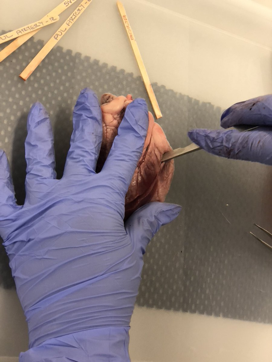 I can’t believe how quickly my Access to HE course has flown by! I’ve loved every minute, even the gory bits… Now I just need one more distinction and I’ll be a first year SLT BSc student at City come Sep ‘22 #slt2b <a href="/CityUniLondon/">Anna</a> <a href="/CityUniHealth/">School of Health & Medical (Clerkenwell)</a> <a href="/morleyscience/">Morley Science</a> <a href="/morleycollege/">Morley College London</a>