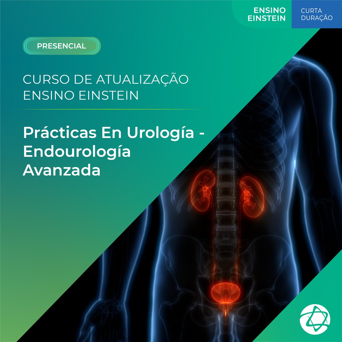 SAVE THE DATE: The 4th SHOU - Simulation and Hands On Course on Advanced Endourology will be held on 29th October. Only 12 spots, in Sao Paulo. If you want to learn Ultrasound ECIRS, Mini PNL and more, come an join us. In Portuguese, Spanish and English. mkt.einstein.br/xKiwVv