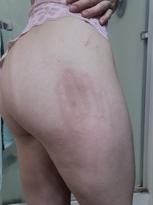 Slap me as hard as you can, please ? https://t.co/fooAxFcwm6<a href="/tag/mexicocity"class="tags"><span>#mexicocity</span></a>