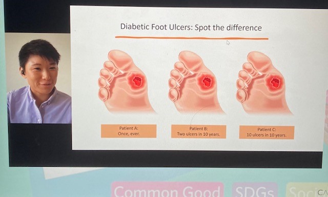 Our sixth presenter Khor @bkycycle from @GCUPodiatry @GCUSHLS with the presentation  'Diabetic Foot Ulcers: Spot the difference' #GCU3MT #GCUResearchCelebration