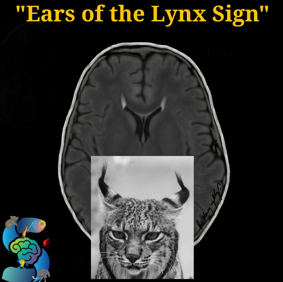 Lynx Ears Sign