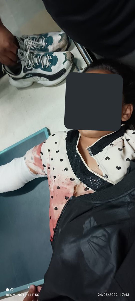 As you sleep tonight, Remember: This 9-year-old girl, ran to save her father #SaifullahQadri when terrorists fired. 
She clung to him, as he battled for life. She was also hit but is stable.

Imagine her trauma for life.
How can you still go quiet against Terrorism In Kashmir?