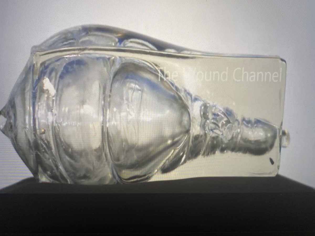 This is the blast effect from an assault rifle. Surgeons cannot save children with this level of injury. It’s much more than the holes on the outside. There is NO place for assault rifles in civilian life. #EnoughIsEnough #uvaldetx <a href="/ThisIsOurLane/">ThisIsOurLane</a> <a href="/POTUS/">President Donald J. Trump</a>