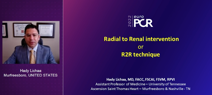 HadyLichaaMD's tweet photo. #R2R: #Radial2Renal presented @ #EuroPCR2022
Novel term & particularly favorable #RadialFirst access
#IVUSfirst + #CO2angio -> ⬇️dye
@EricSecemskyMD @mirvatalasnag @prkothapalli @jcgeorgemd @agtruesdell @kerrigjl @adityadoc1 @RajTayalMD @mcbunte @sealtin1 @AkramWIbrahim https://t.co/bnn9lE52h8