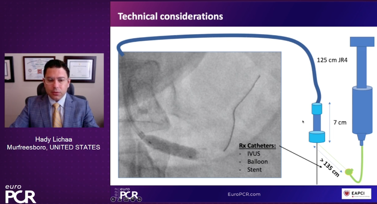 HadyLichaaMD's tweet photo. #R2R: #Radial2Renal presented @ #EuroPCR2022
Novel term & particularly favorable #RadialFirst access
#IVUSfirst + #CO2angio -> ⬇️dye
@EricSecemskyMD @mirvatalasnag @prkothapalli @jcgeorgemd @agtruesdell @kerrigjl @adityadoc1 @RajTayalMD @mcbunte @sealtin1 @AkramWIbrahim https://t.co/bnn9lE52h8