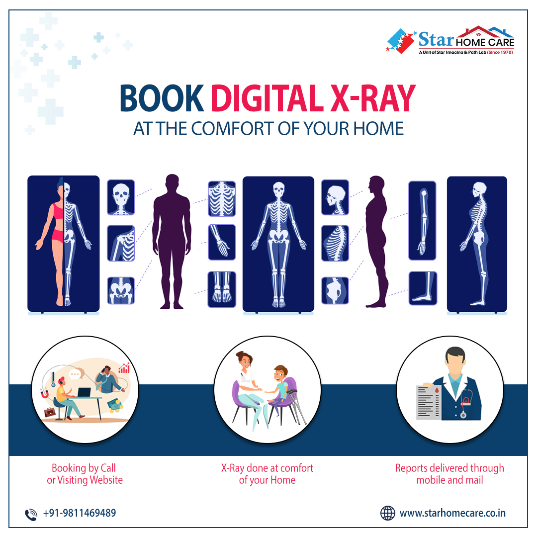 star_home_care's tweet photo. Avail X-Ray at Home Services by Star Home Care at Your Doorstep.
โข X-Ray done at the comfort of your Home.
โข Digital Reports are delivered through mobile and mail.
Call us now at +91-9811469489 or visit: https://t.co/RdlZOuvqkz
#starhomecare #digitalxray #xrayathome https://t.co/pA23vnGhPu