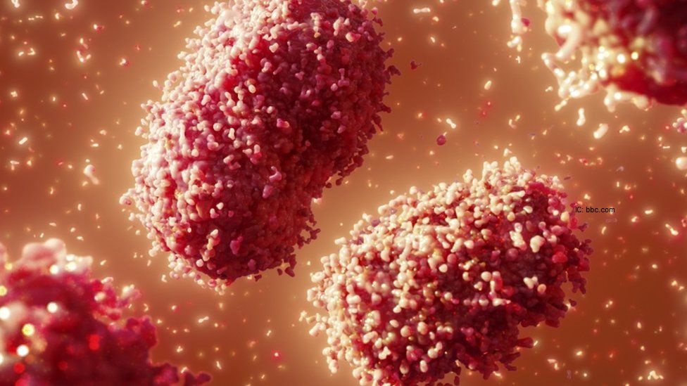 TeamDigitalMar1's tweet photo. Monkeypox Cases Detected In Three Countries
https://t.co/1NHhhMDZxg
#MonkeypoxVirus #monkeypox #UAE https://t.co/J7aFNdwLyV
