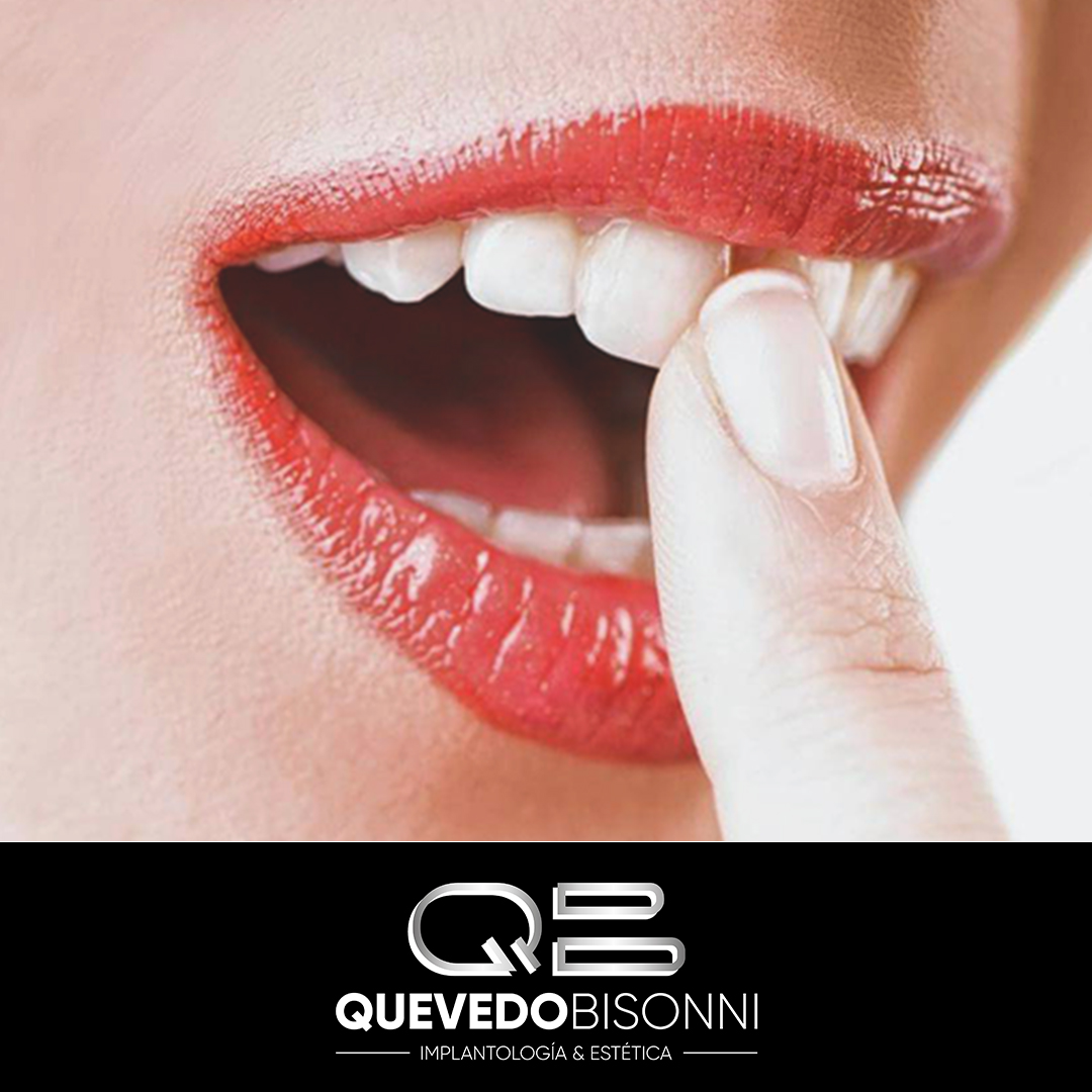 CQuevedoBisonni's tweet photo. ¡Buenos días Sonrisas! ¿Qué se desaconseja ante una situación de dientes flojos?
Los dientes flojos se pueden deber a un traumatismo leve. No se deben tocar con la lengua ni los dedos ni apretar los dientes.
.
.
#sonrisasana #dientessanos https://t.co/umaYFlONsg