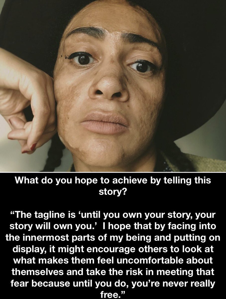 Interview with our Co-Artistic Director Chantelle Dusette about her new play <a href="/DOLLY_theplay/">DOLLY by Chantelle Dusette</a> which runs at <a href="/ParkTheatre/">Park Theatre</a> until Saturday.