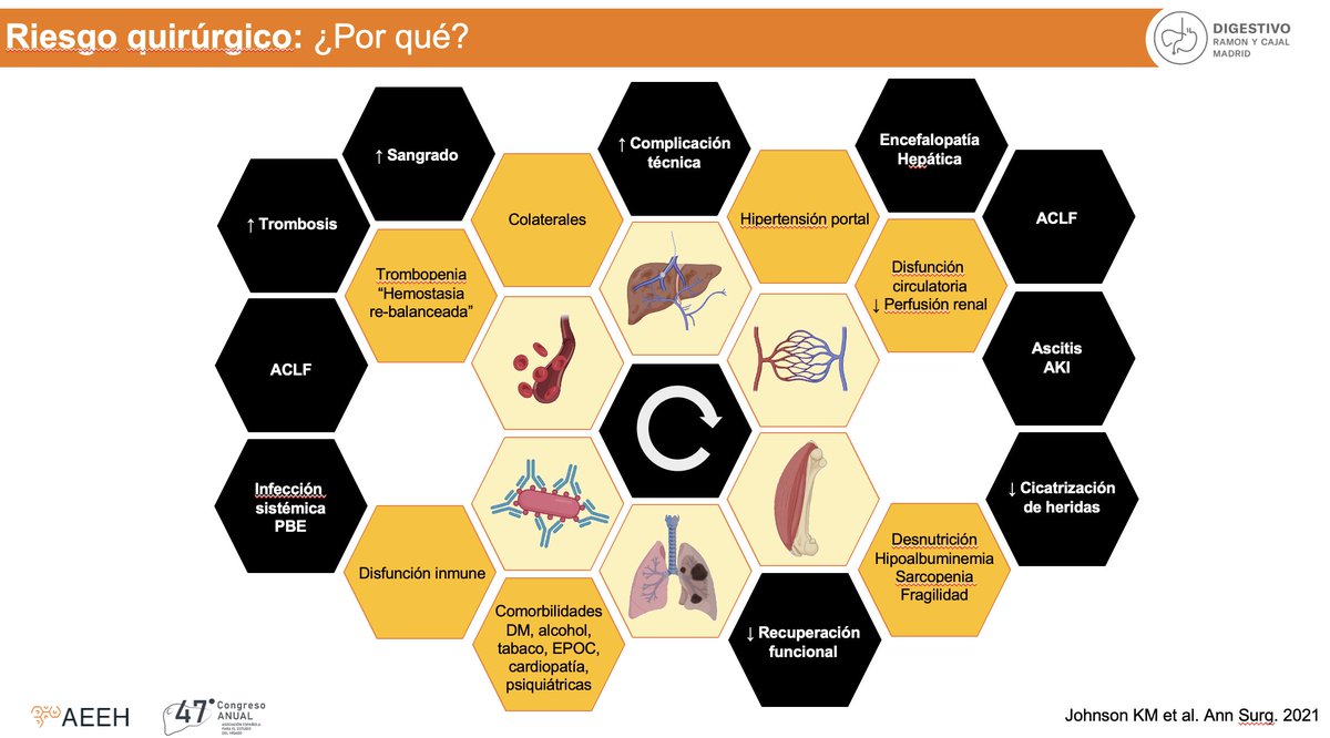 ¿Por qué los pacientes con #cirrosis hepática tienen un mayor riesgo quirúrgico (de lo que sea)?

🥇 <a href="/luistevilla/">Luis Téllez</a> y la que, probablemente sea la mejor diapositiva del año en hepatología. Y eso que no la habéis visto animada!

#AEEH2022 #LiverTwitter