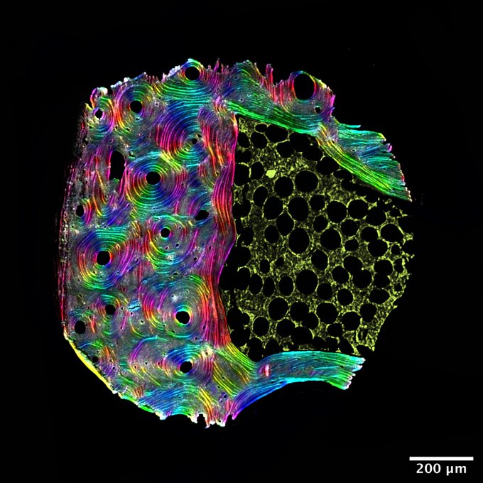 BoneResearchSoc's tweet photo. Here is the beautiful Kaleidoscopic Bone image by our 2021 BRS winner Belle Creith @BelleCreithBio Submissions for 2022 BRS Judith Adams Imaging Competition now open. Please submit entries in .png to brsimagingaward@gmail.com by noon July 4th 2022 #BRSImage22 #boneimaging https://t.co/gjm944PlEE