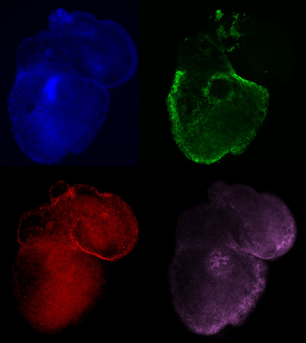 Human heart organoids looking more and more like tiny human hearts lately. Keep tuned for more info on the new protocol!