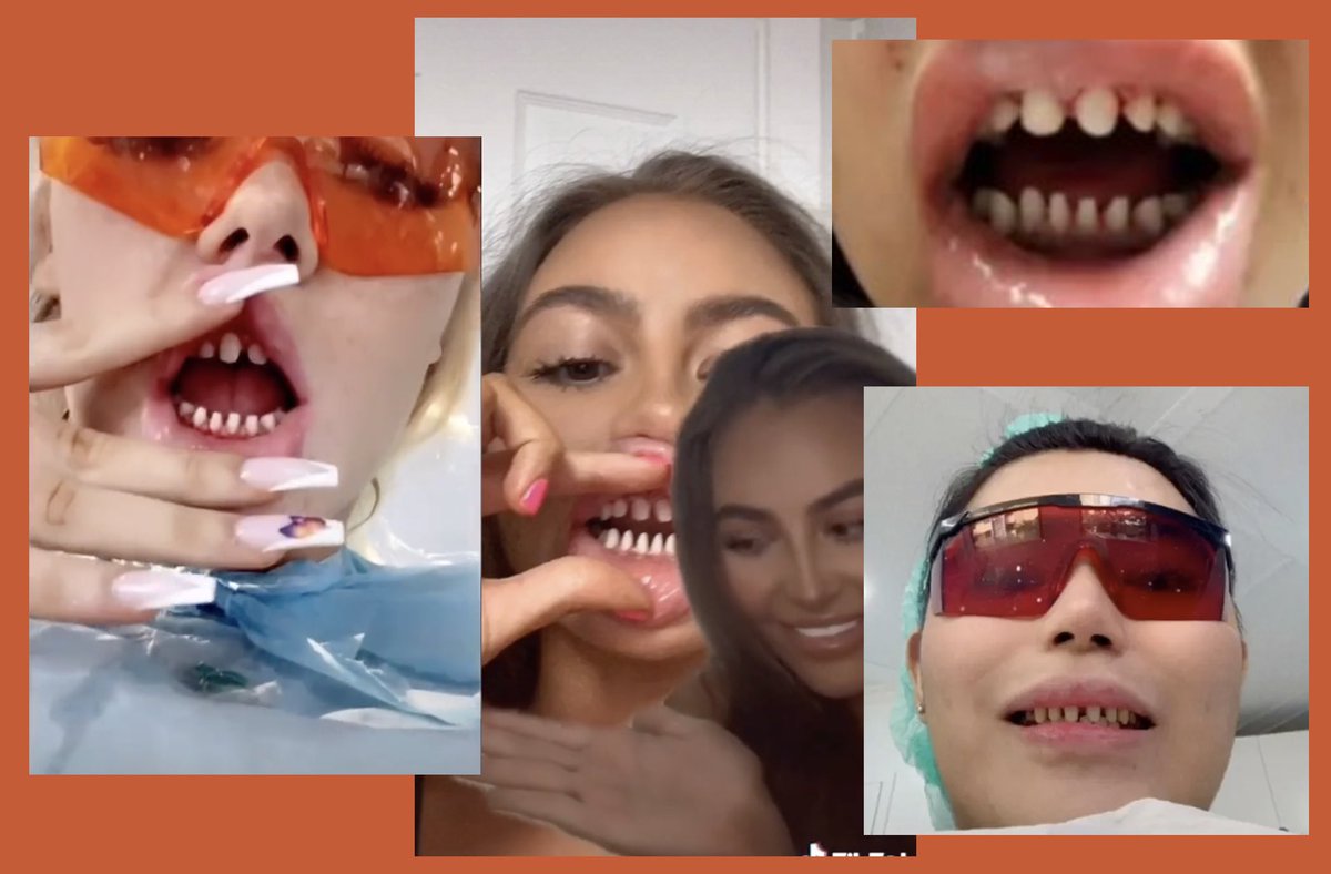 leroidesrats's tweet photo. Comment ça me terrifie les gens qui se font limer les dents pour se faire poser des facettes, top 5 cauchemar https://t.co/p3EpatZ1i2