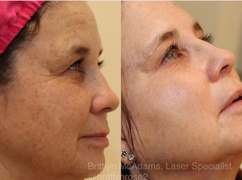Nayak Plastic Surgery & Avani Derm Spa tweet media