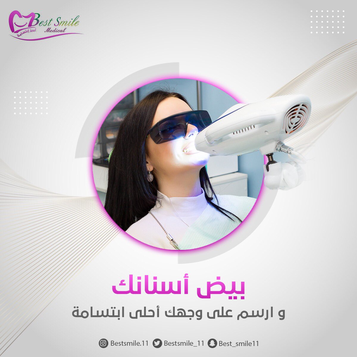 bestsmile_11's tweet photo. تخلص من تصبغات الأسنان واسترجع 
لها بياضها الناصع مع
 تقنية تببيض الأسنان بالليزر  
احجز موعدك الآن وتألق بابتسامتك https://t.co/lbJemihvBa
