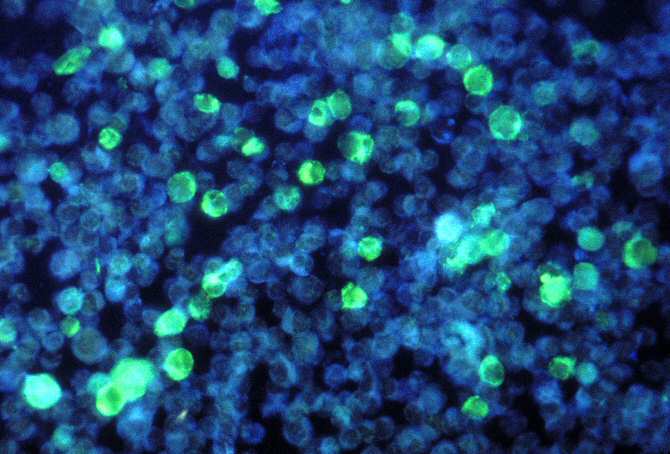 🇪🇸 <a href="/CSIC/">CSIC</a> <a href="/CNB_CSIC/">Centro Nacional de Biotecnología (CSIC)</a> 🔬

Descifrado el mecanismo molecular de una enfermedad que causa inmunodeficiencias graves.

noticiasdelaciencia.com/art/44292/desc…
