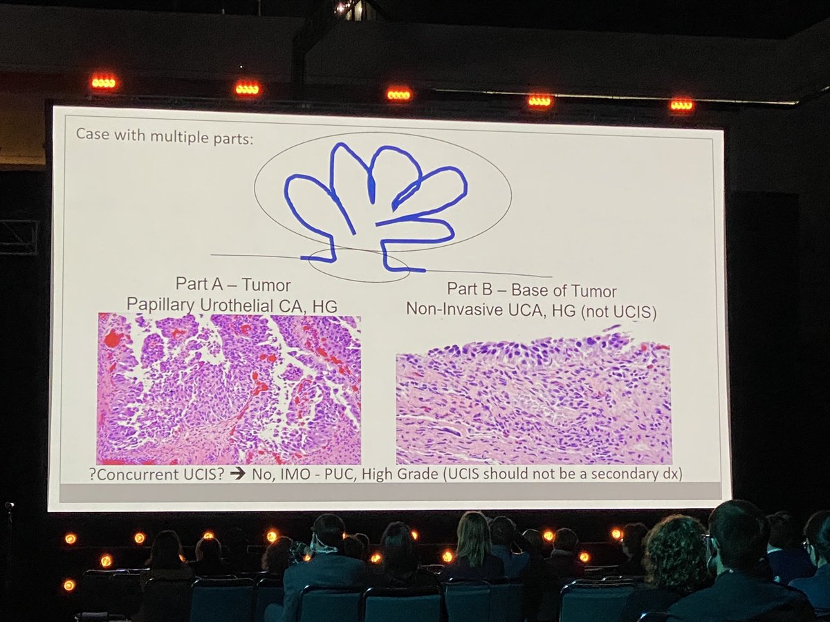 slusagar's tweet photo. more recently: @MichelleDunno17 discussed this issue at @GU_Path_Society #USCAP2022 https://t.co/ekO0pbczKe