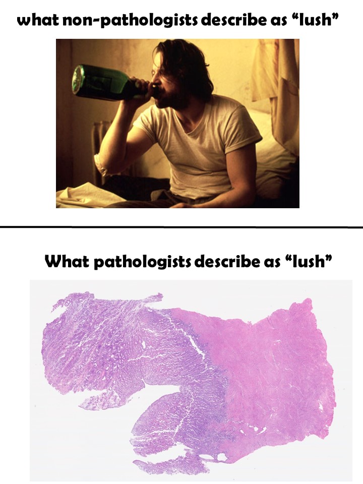 slusagar's tweet photo. #GYNpath #pathmeme https://t.co/KJrj4q7T2s