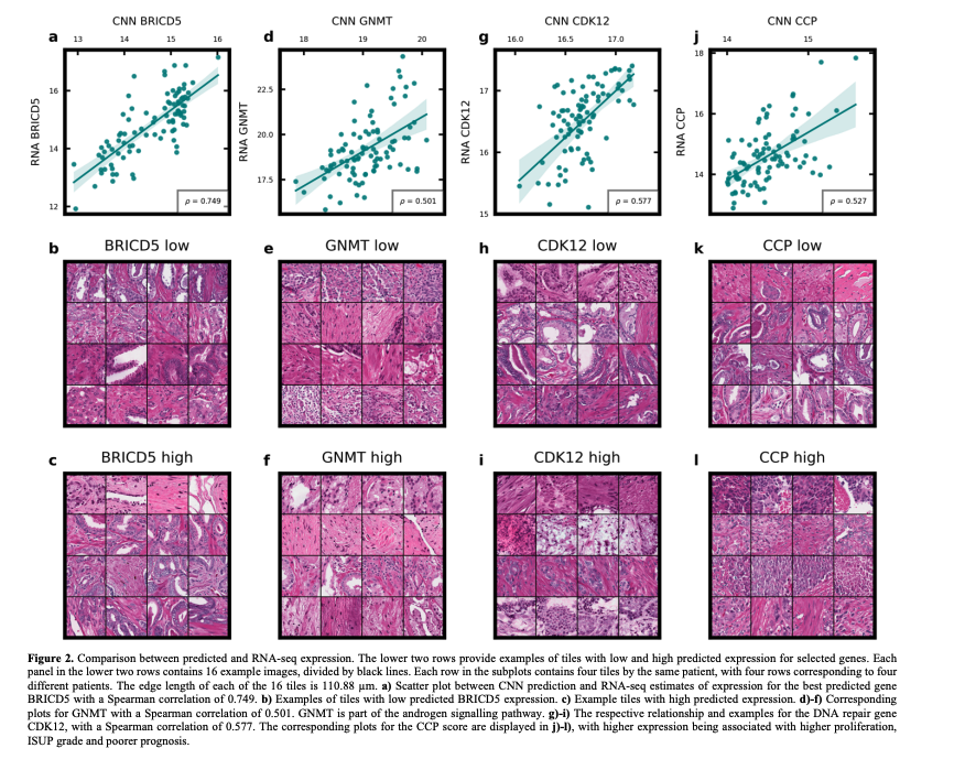BioDecoded's tweet photo. Transcriptome-wide prediction of prostate cancer gene expression from histopathology images using co-expression based convolutional neural networks | Bioinformatics
https://t.co/PxIkEdpLIf

#Bioinformatics https://t.co/C1m0MdFDnO