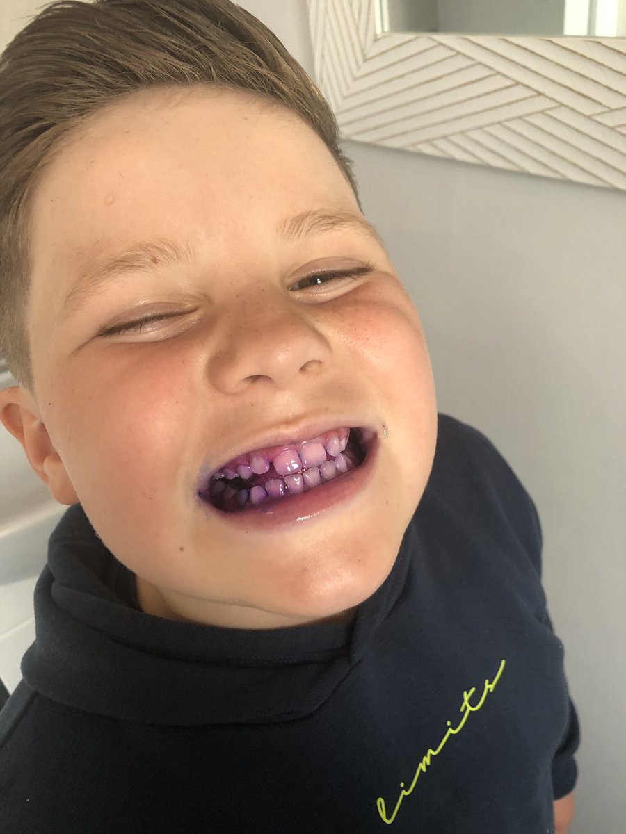 nicolarostron2's tweet photo. @StJamesYear3 Declan was excited to do his plaque reveal today after school! Here are the results! 🦷 https://t.co/4xv9YhKQHY
