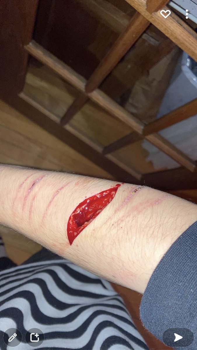n3crobf's tweet photo. here’s another one / shtwt goretwt ouchietwt https://t.co/9bTW16axF4