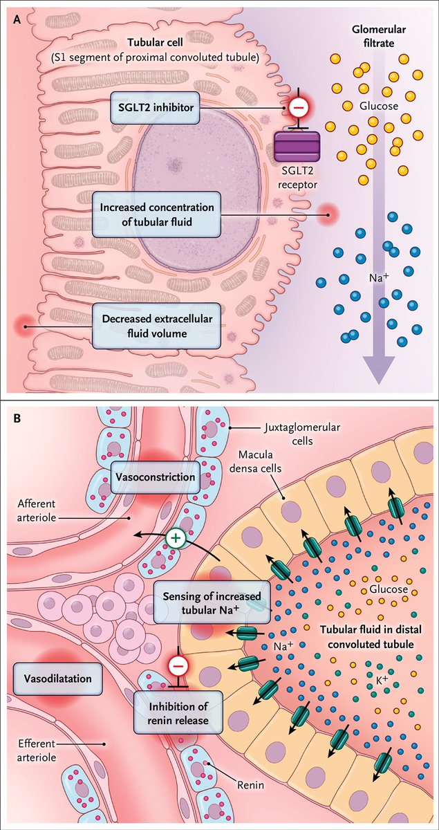 HanCardiomd's tweet photo. This Eminent review by #EugeneBraunwald in @NEJM 

This article reviews the actions of #SGLT2i and their implications by legendary #Braunwald 

https://t.co/H0dnrxDvQc @AndrewJSauer @AnastasiaSMihai @NEJM @hvanspall @BiykemB @AnnaKateBarton @LuchianLuiza @AShchendrygina https://t.co/ZHoTZBrda0