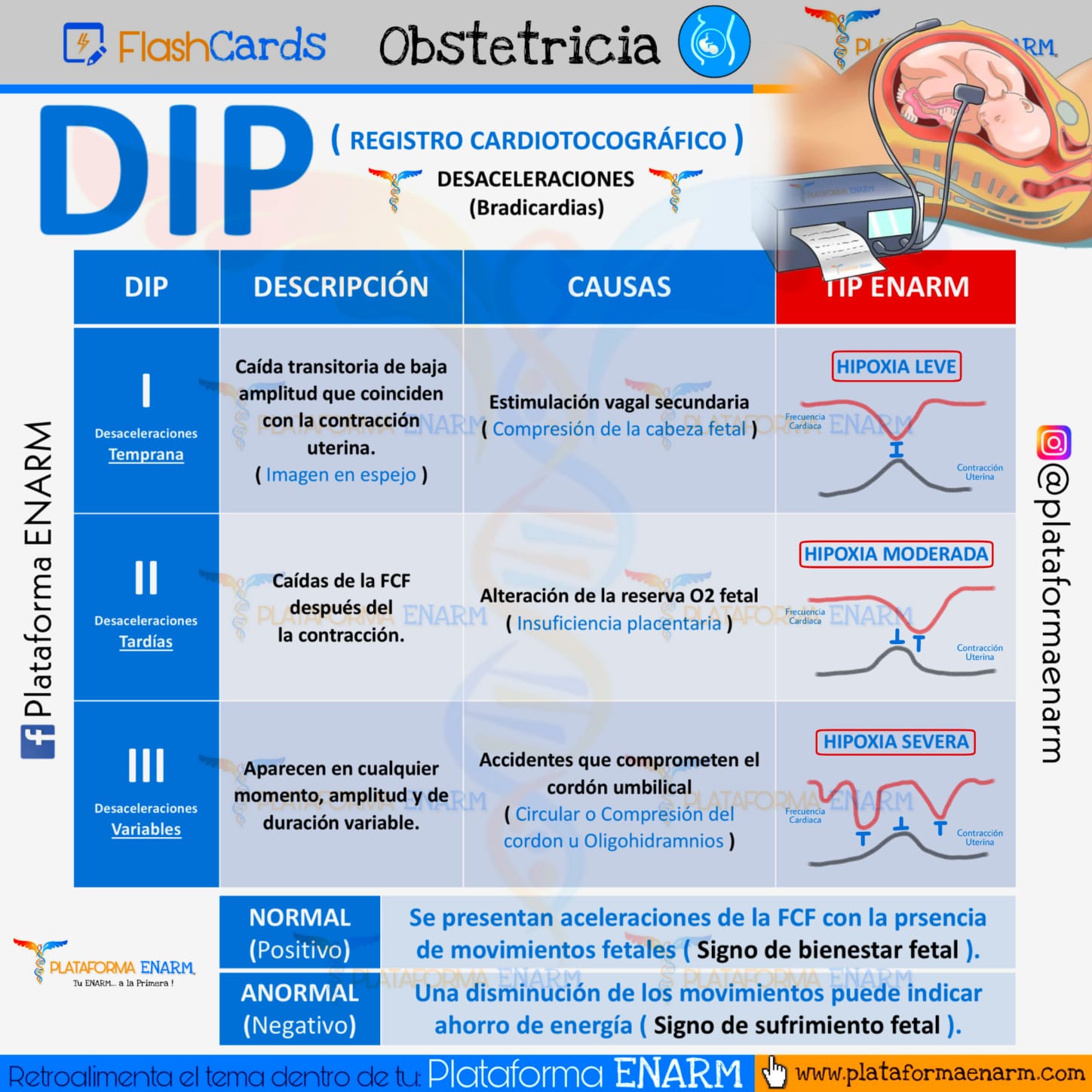 plataformaENARMoficial on Twitter "DIP (RIESGO CARDIACOTOGRÁFICO) 🤱 💥
