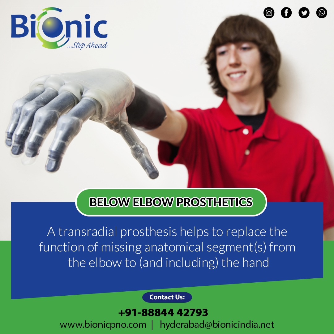 BionicOrthotics's tweet image. Below Elbow Prosthetics
A Transradial prosthesis helps to replace the function of missing segment(s) from the elbow to (and including) the hand.

@bionic_india
Contact us - +91-7678592509
info@bionicpno.com
bionicpno.com

#bionic #elbowjoint #elbow #upperarm #neurologic