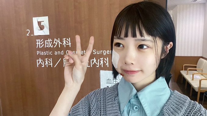 あの バイク転倒で顔を骨折 パンパンになっちゃった モデルプレス