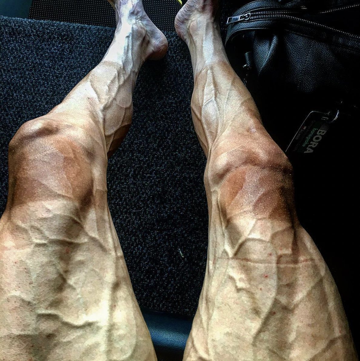 Les jambes du cycliste polonais Pawel Poljanski, après une étape du Tour de France.