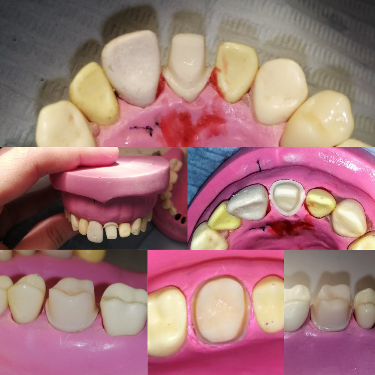 MahmoudRoushd20's tweet image. ممتن للطف ربنا ال دايما محاوطني وان لولا توفيق ربنا وكرمه الواحد مكنش قدر يعدي الايام دي ع خير الحمد لله وربنا يديم علينا كرمه وتوفيقه
#Practical_Exams❤️💛🥺