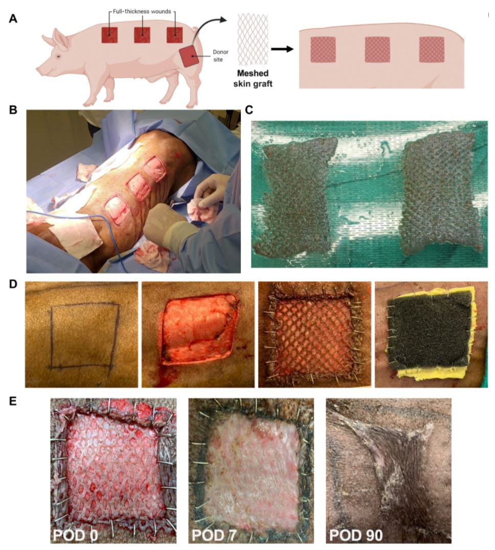 Disrupting mechanotransduction decreases fibrosis and contracture in split-thickness skin grafting great work done by @do_henn @kellenchen etc. in @ScienceTM @Innov_Medicine #MedTwitter #patchwork2022 #skincare #health #transduction science.org/doi/10.1126/sc…