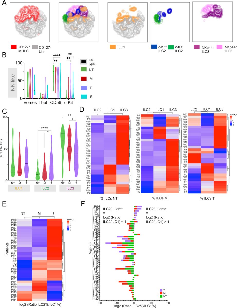 Gut Journal (@gut_bmj) on Twitter photo Great #GUTImage from the paper Heinrich et al on
"The tumour microenvironment shapes innate lymphoid cells in patients with hepatocellular carcinoma" via bit.ly/3sBzd1a
#LiverTwitter #HCC
<a href="/BenniRuf/">Benjamin Ruf</a>, @JackMcVey14 Great #GUTImage from the paper Heinrich et al on
"The tumour microenvironment shapes innate lymphoid cells in patients with hepatocellular carcinoma" via bit.ly/3sBzd1a
#LiverTwitter #HCC
<a href="/BenniRuf/">Benjamin Ruf</a>, @JackMcVey14