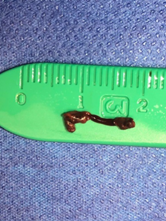 PenNeuro's tweet image. US HCPs: #RED72 delivers results in the hands of Dr. Tarpley at the Providence Little Company
of Mary Medical Center in Torrance, CA. #REDglideDifference #StrokeAwarenessMonth Rx only. For risk
info: bit.ly/37YcYIU Clinical results may vary.