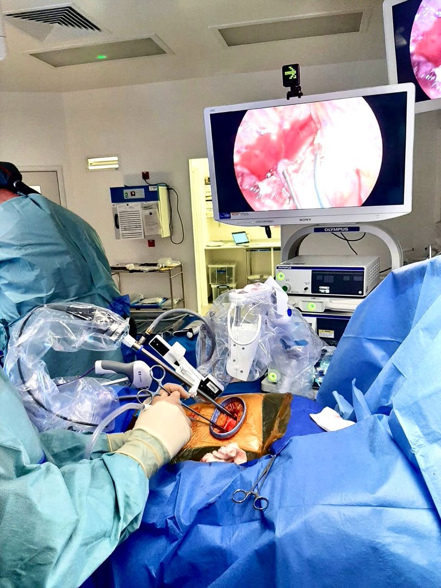 "I’m baffled how anyone finds a human better than a robotic scope holder for most longer or more complex minimally invasive surgery cases."
"No tremor, much less scope soiling, less fatigue and more space. More comfortable for trainer. Few mins set up and take down."
#Laparoscopy