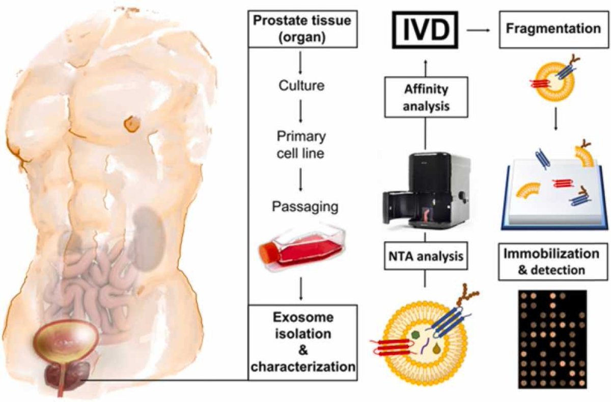 ProstateCell's tweet photo. π©βπ¬π¨βπ¬ Researchers examined several isolation procedures, exosome storage conditions and other conditions affecting exosome production by #ProstateCell lines.
Read the #OpenAccess article here π https://t.co/DMuLYCvKY5 https://t.co/Ikw1EDzimb